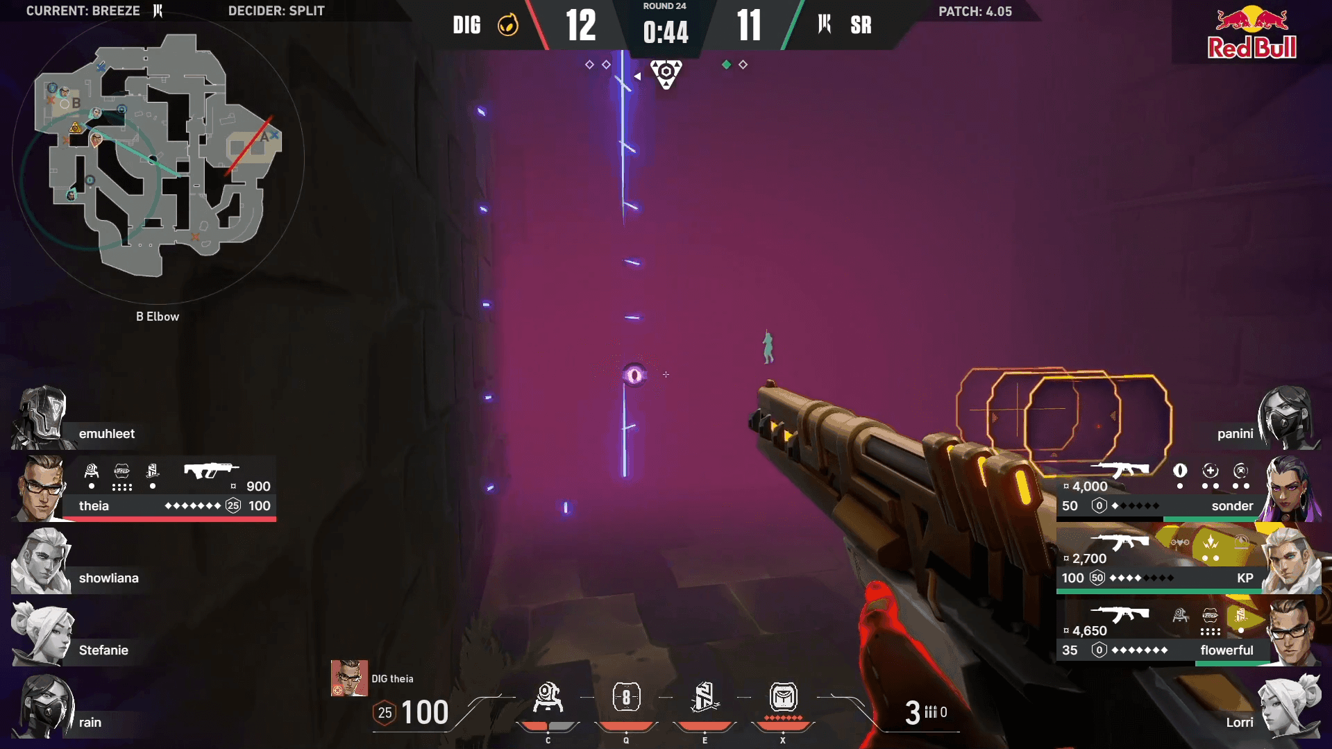 Leer Versus Sniper